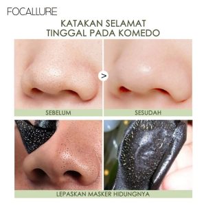 Cách dùng Công dụng Miếng dán mũi Focallure lột mụn đầu đen