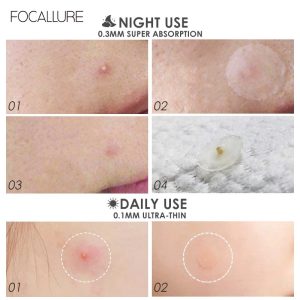 Miếng dán mụn Focallure ngày và đêm